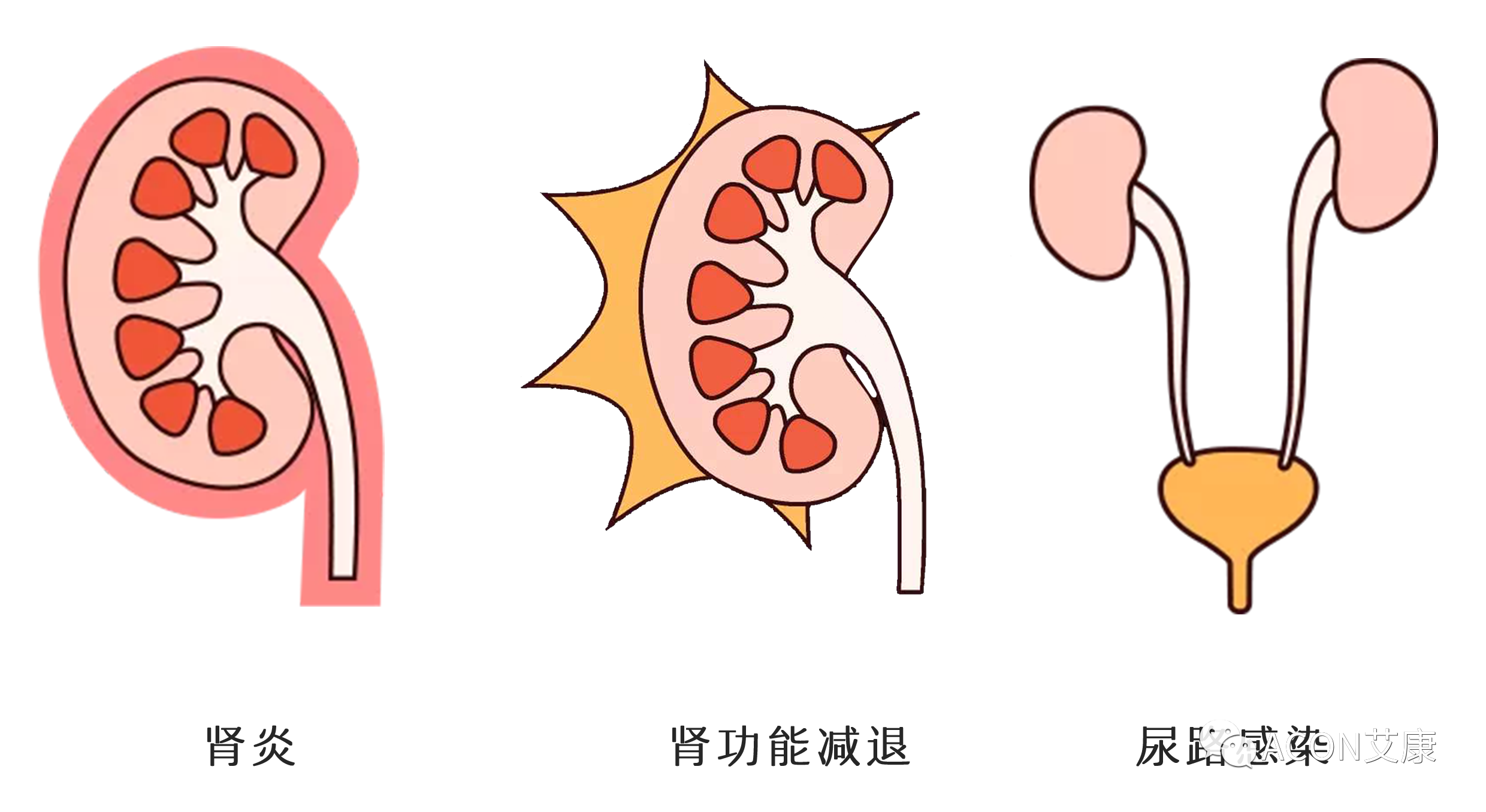 排尿黄、异味大，可能是身体在报警！