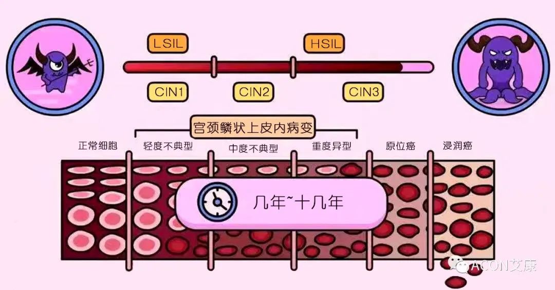 全球首次承诺消除一种癌症，预计到2050年将挽救500万人的生命